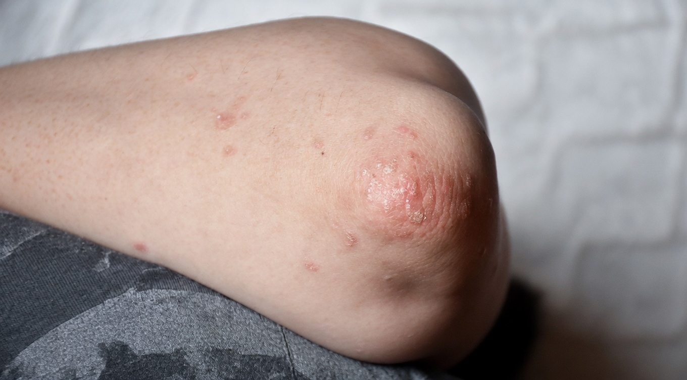 Vaseline + Salt Trick: The Old-School Hack for Tighter, Smoother Skin That’s Quietly Going Viral Again