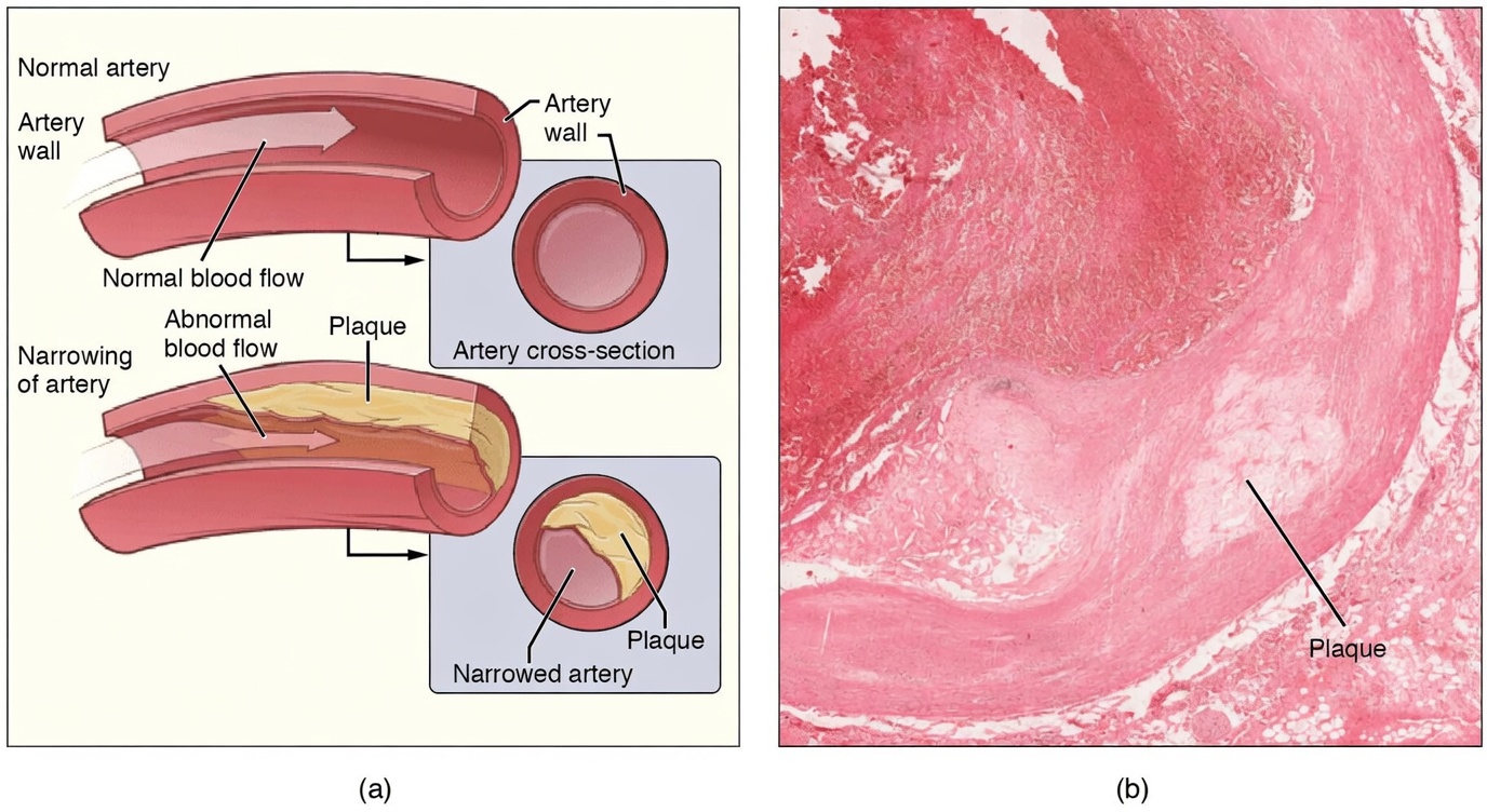Mix These 3 Everyday Items Before Bed – Watch Your Arteries Soften While You Sleep
