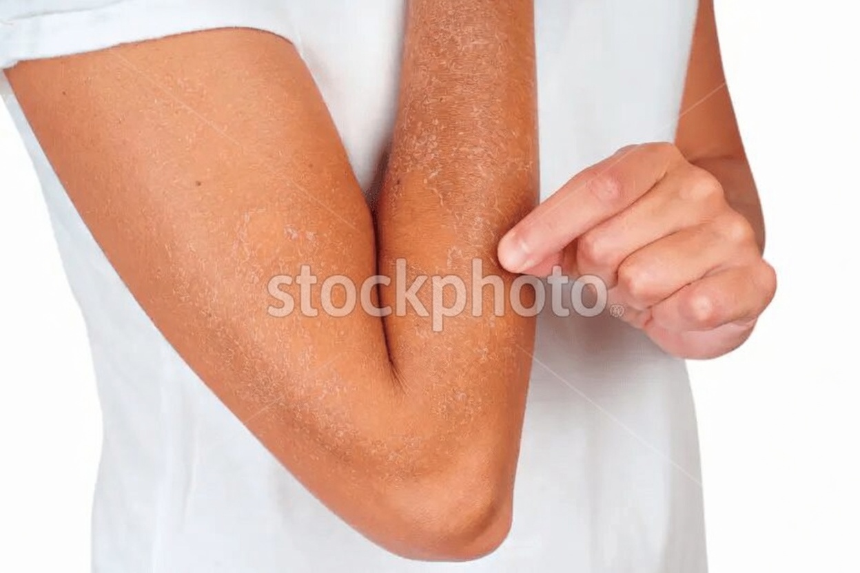 23 Important Warning Signs Your Kidneys Might Be Quietly Struggling and Need Attention