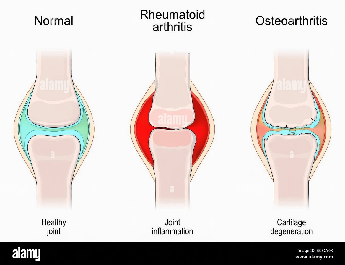 Fast Relief! This Will Naturally Ease Joint Pain