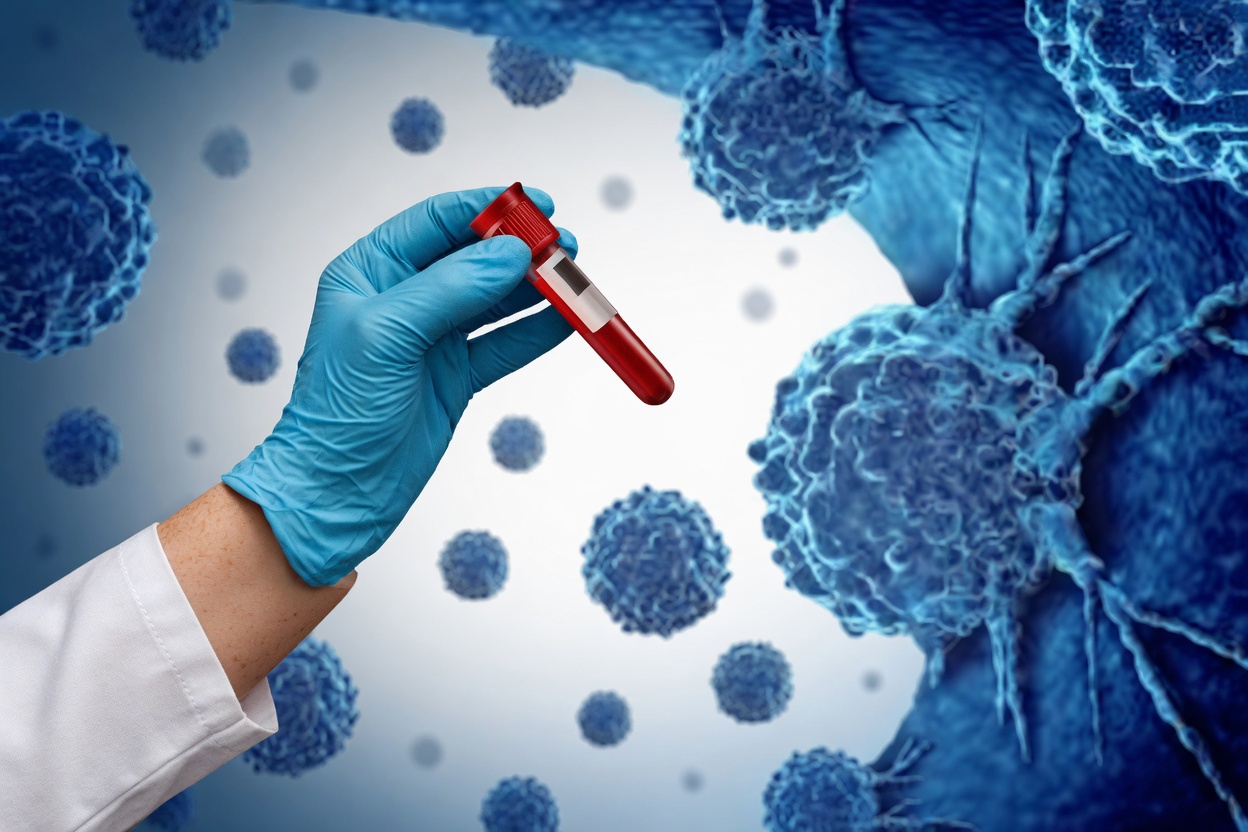 8 Common Signs That May Indicate Cancer Is Growing in Your Body