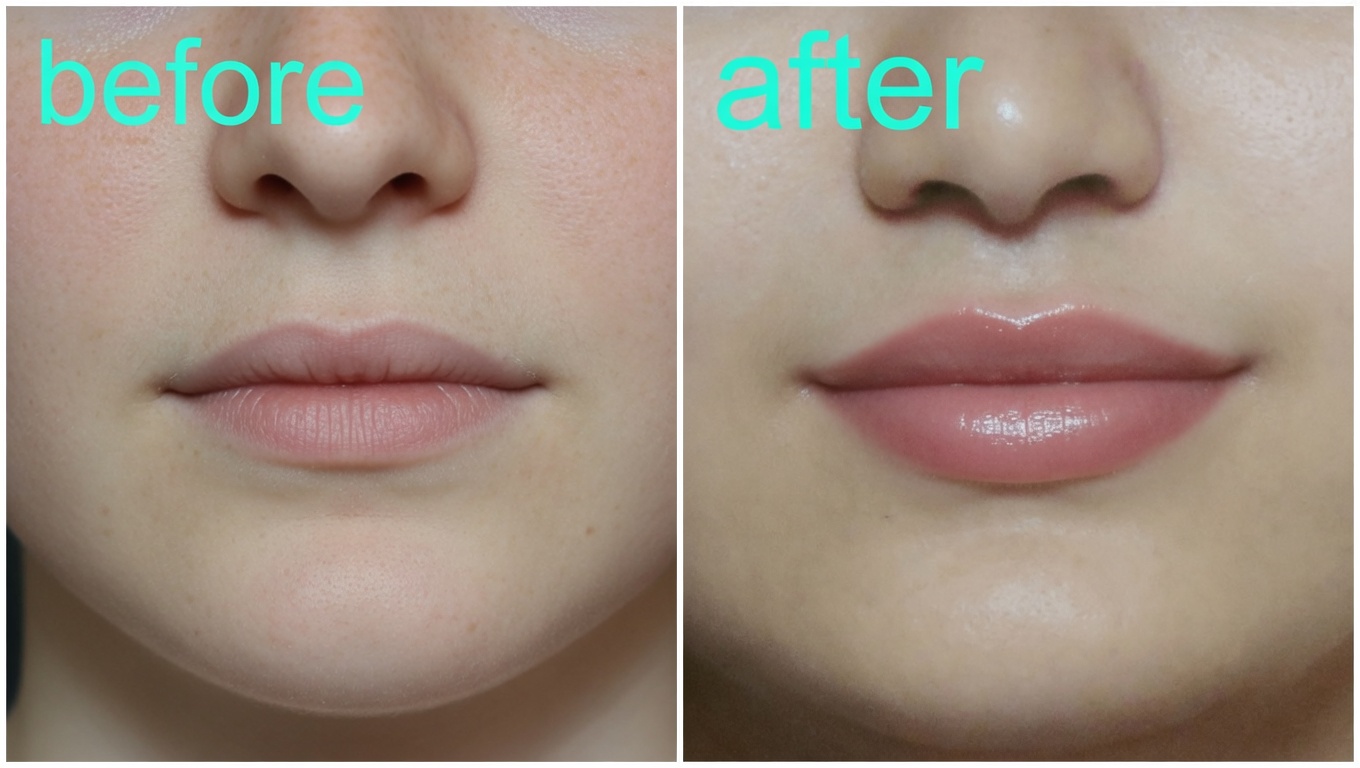 Erase Wrinkles Overnight with Rice Water: Unlock 20 Years Younger Skin Instantly!