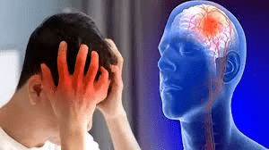 10 Warning Signs of a Stroke One Month Before – Unbelievable Signs… Revealed!