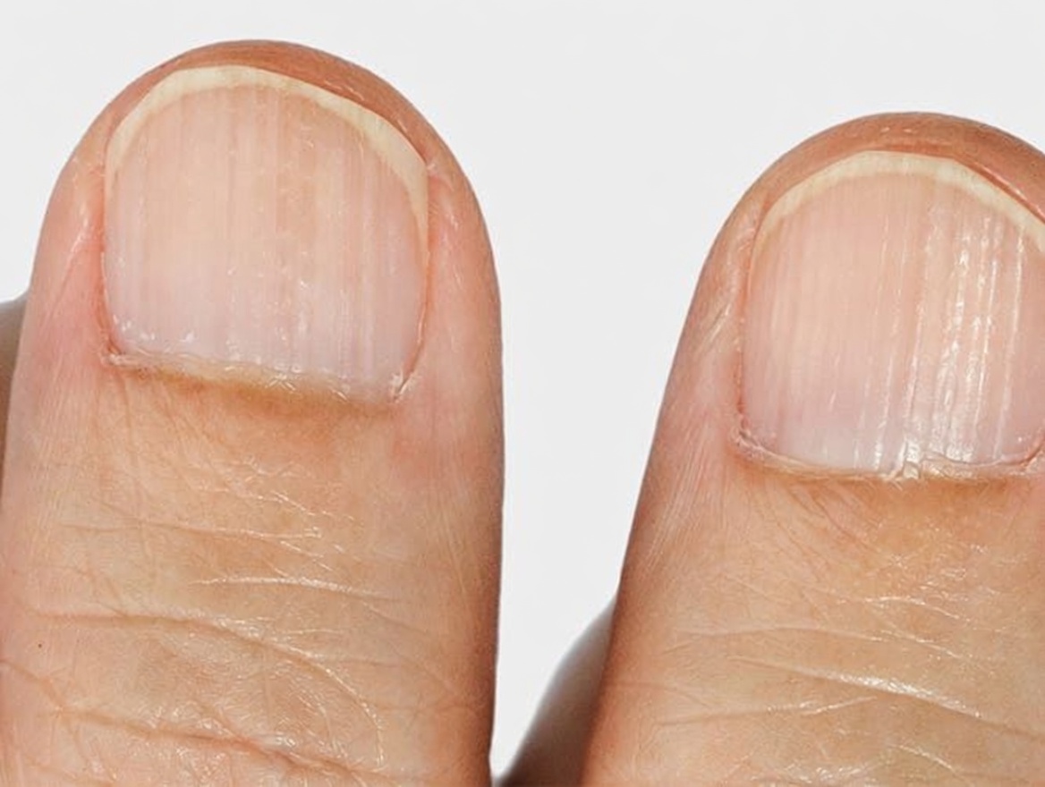 7 Silent Body Signs That May Reveal Hidden Nutrient Gaps After 60