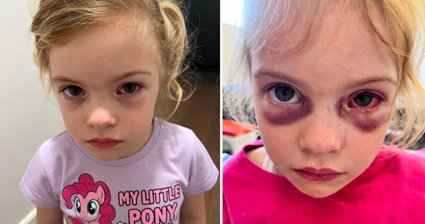 Toddler’s Eye Glued Shut With Yellow Gunk? Gentle Home Cleaning Tips Parents Should Know