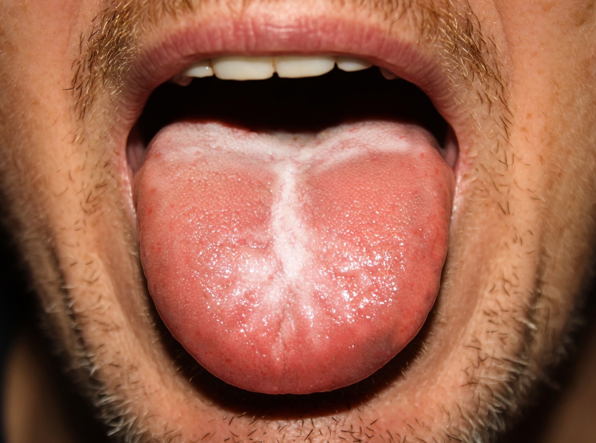 What Does Your Tongue Color Reveal About Your Health Habits
