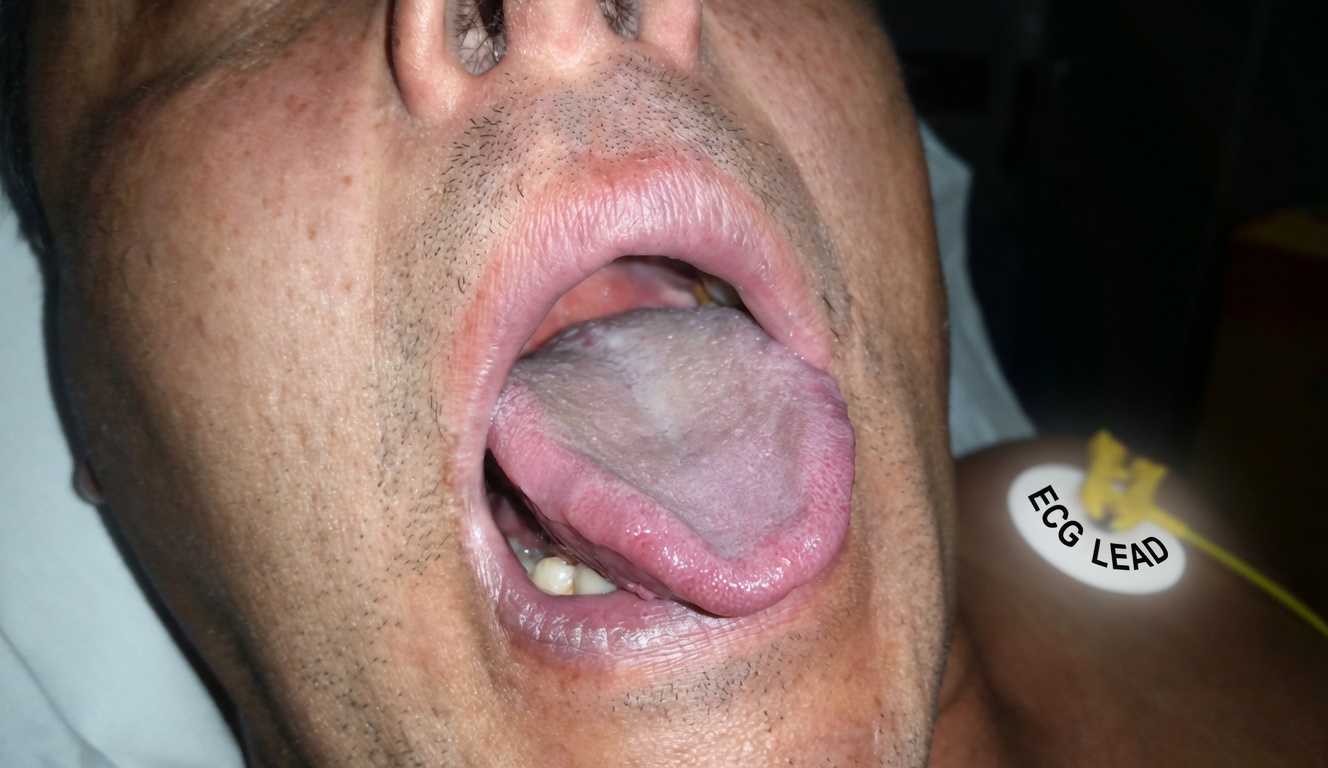 What Does Your Tongue Color Reveal About Your Health Habits