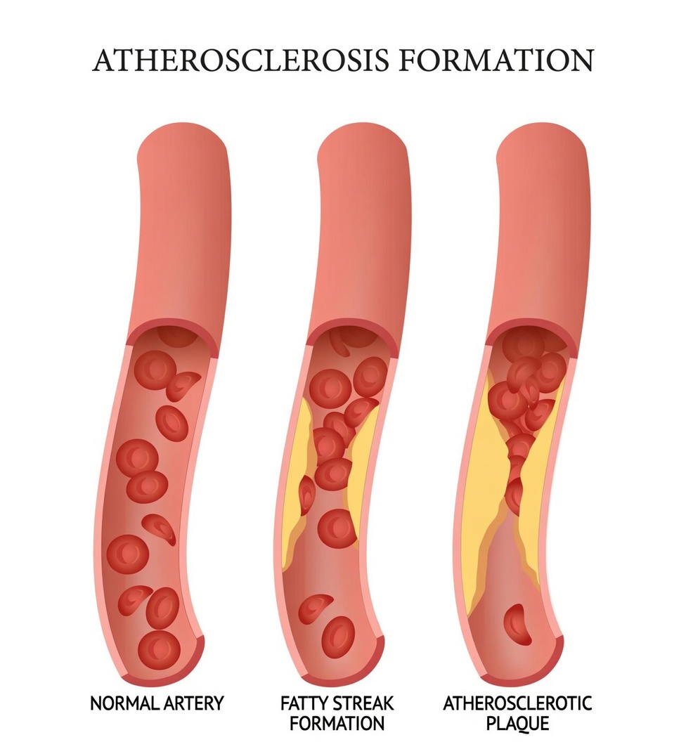 Natural Habits and Daily Tips to Support Healthy Arteries