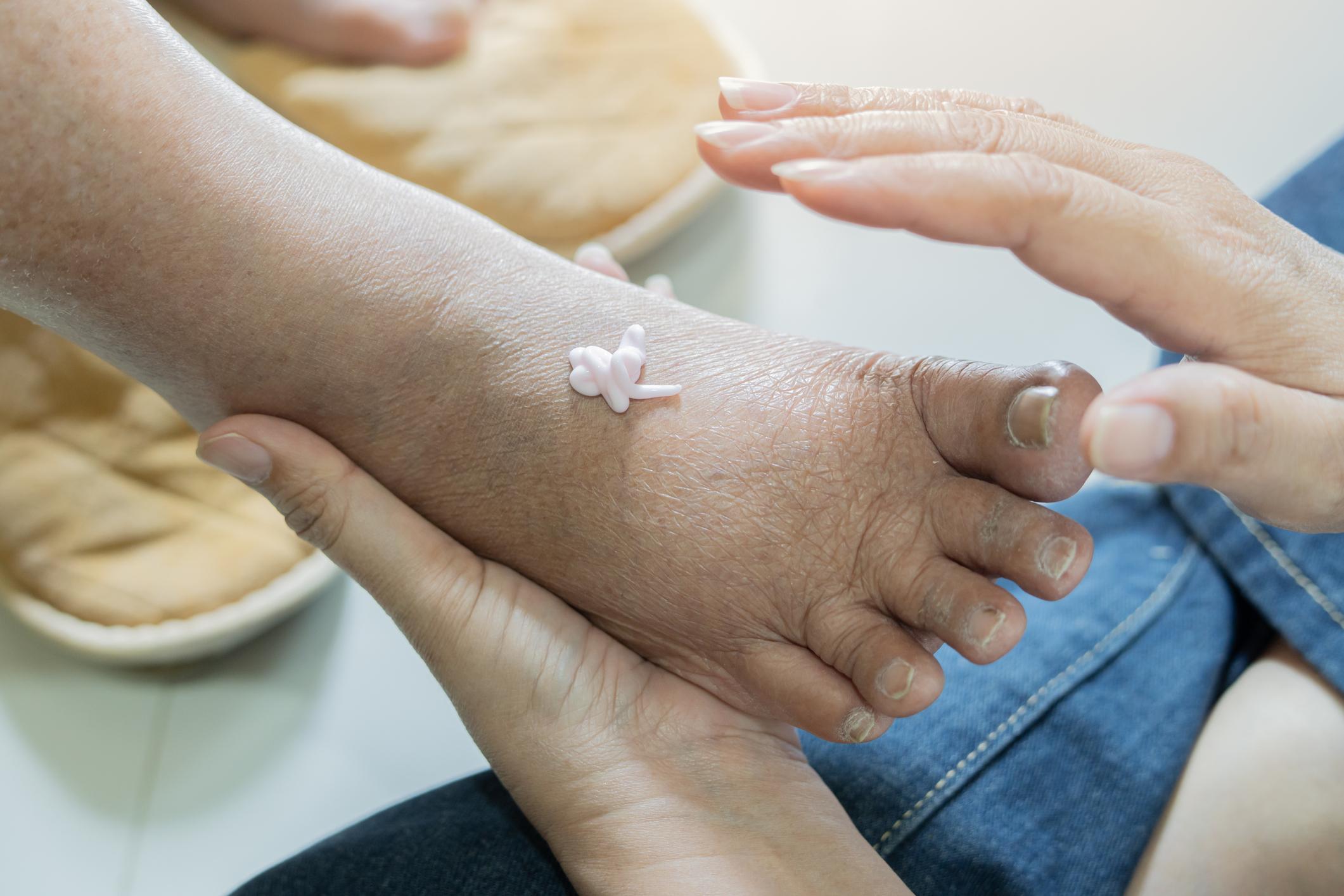 Seniors: Are Your Feet Quietly Suffering? Try This Apple Cider Vinegar Routine