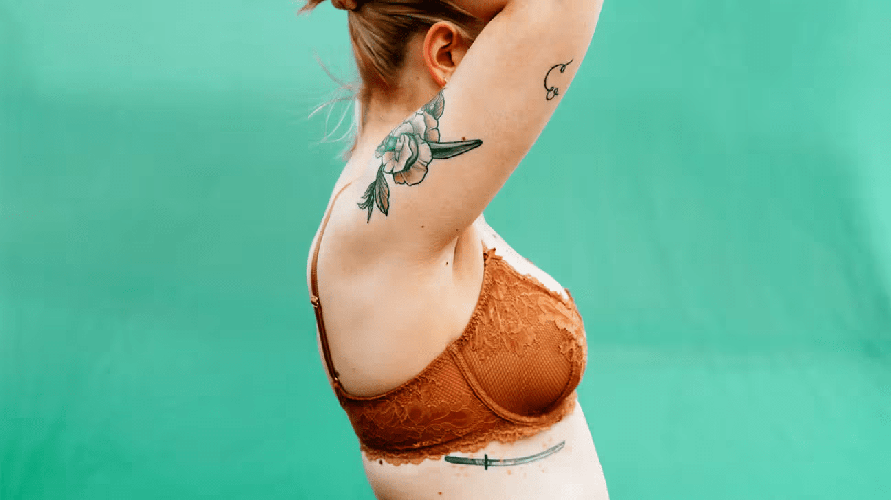 What to Do for an Itchy Rash Under Your Breasts This Winter When Your Doctor Isn’t Available