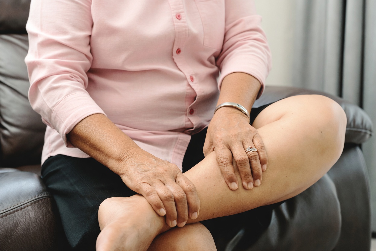 Women Over 60: 10 Signs in Your Legs That Could Indicate a Potential Stroke Risk – What to Watch For