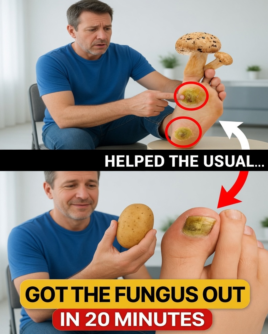 Erase Nail Fungus Like Magic: This Natural Remedy Wipes It Out Overnight