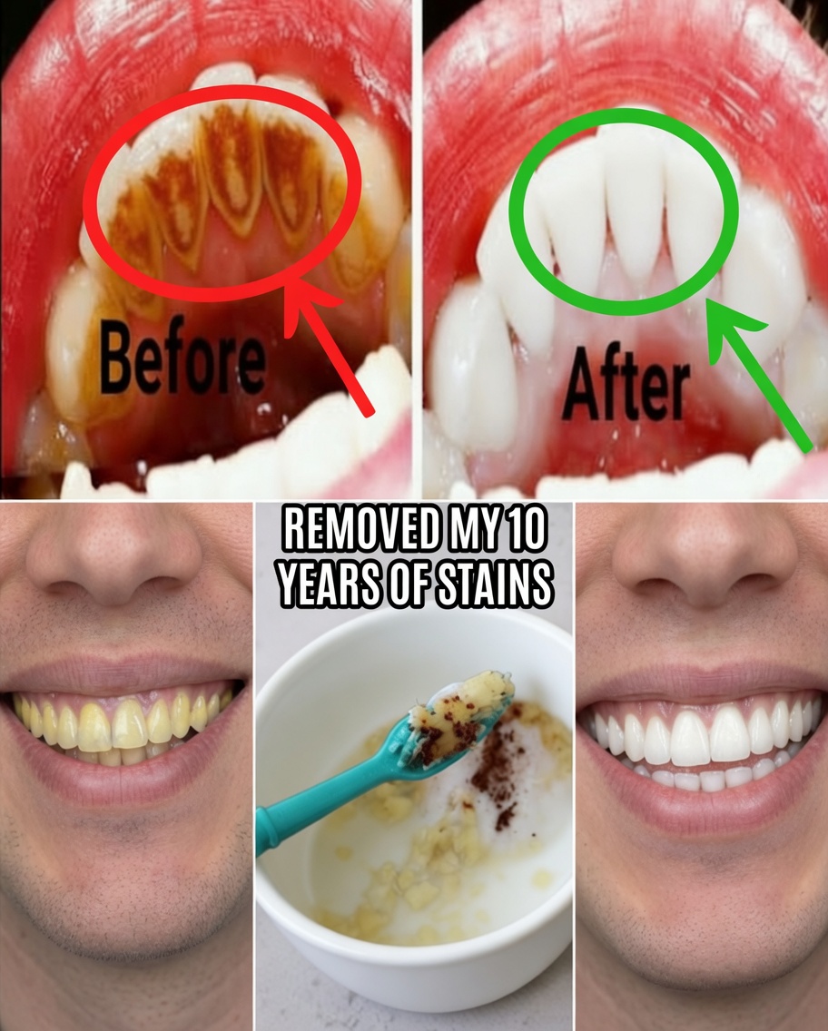 Whiten Teeth in 2 Minutes: The Banana Peel Secret That Shocks Everyone