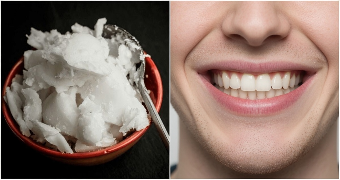 Whiten Teeth in 2 Minutes: The Banana Peel Secret That Shocks Everyone