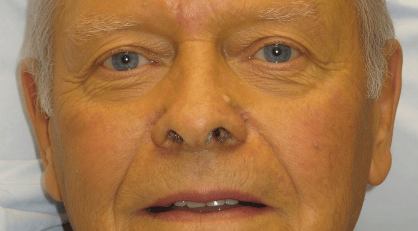 8 Strange Signs Your Body Might Be Begging for More Vitamin B12