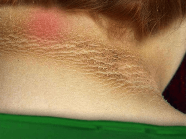15 Early Warning Signs of Diabetes You Should Recognize for Better Health Awareness