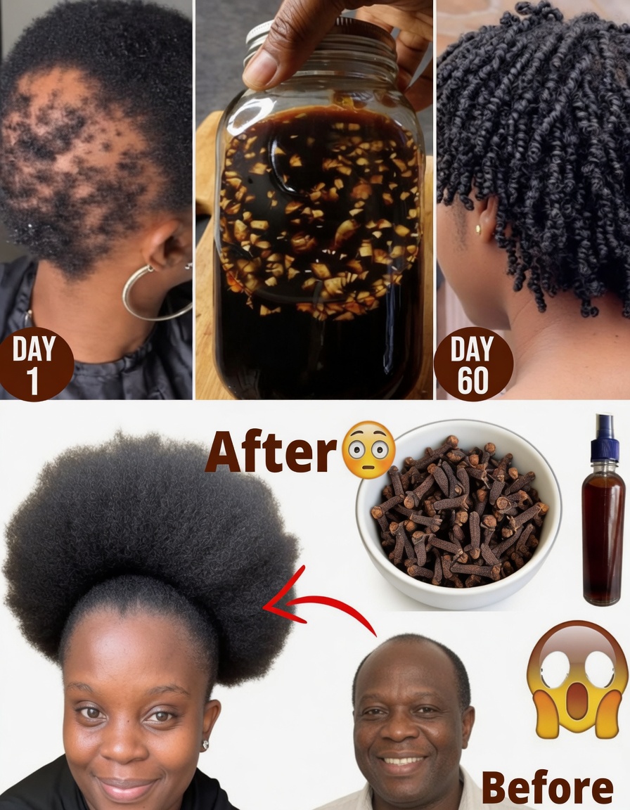 Cloves, Rosemary, and Ginger: The Simple 3-Ingredient Hair Growth Tonic That’s Shocking People (Better Than Aloe Vera?)