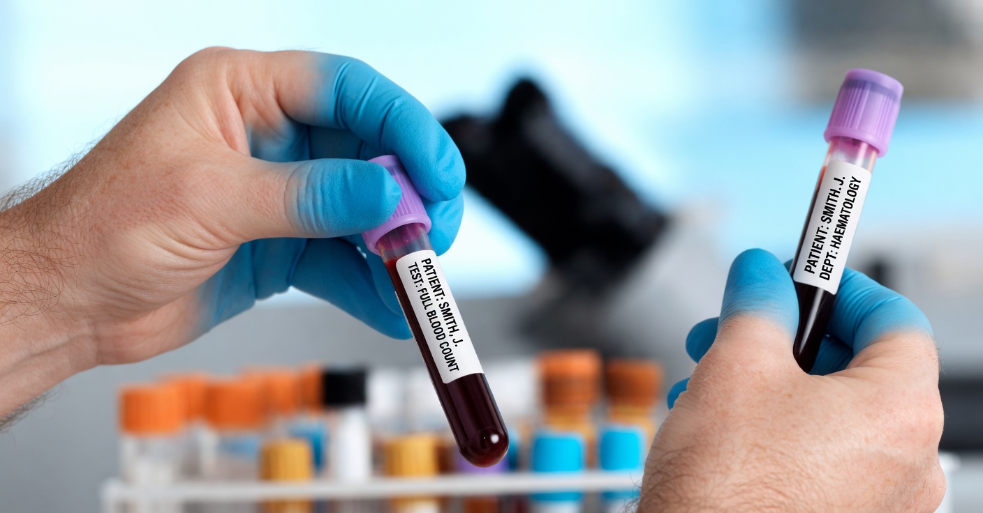 Doctors Reveal: Blood Type O Appears Linked to the Lowest Overall Cancer Risk in Multiple Studies