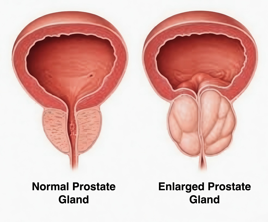 Rediscover Comfort: One Everyday Fruit That May Support Prostate Health