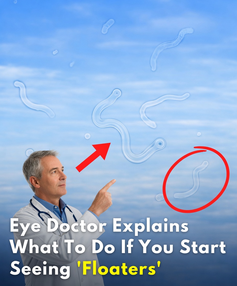 What to Do If You Start Seeing Eye Floaters: An Eye Doctor’s Helpful Guide