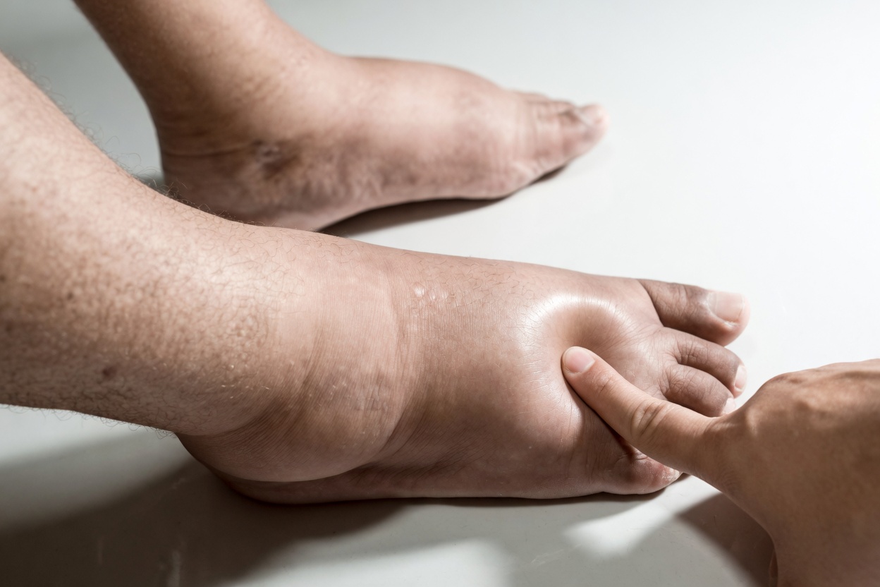 10 Warning Signs Your Kidneys May Be in Danger