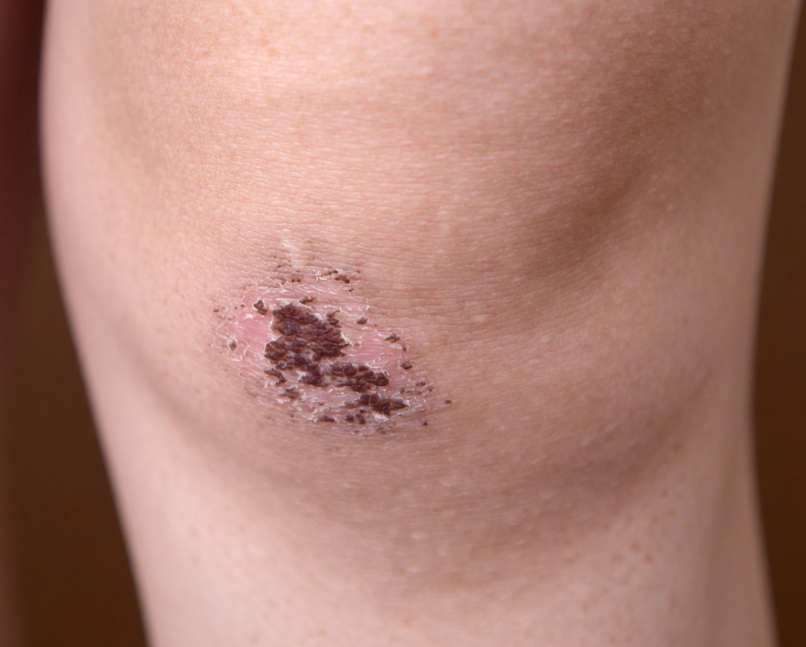 Could Your Body Be Begging for More Vitamin D? Discover These 8 Strange Signs