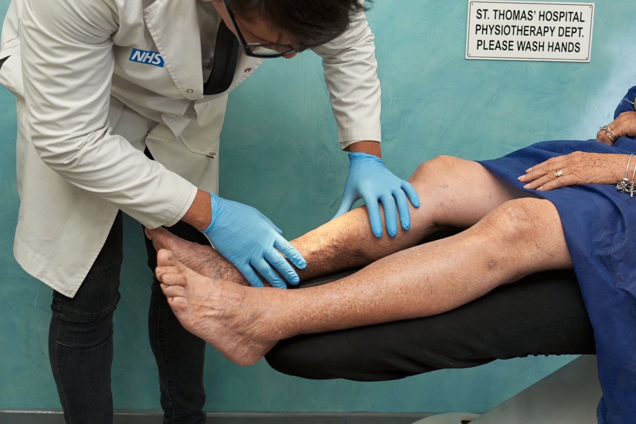 Over 60 Women! These 10 Leg Signs Mean a Stroke Is Coming – Act Before It’s Too Late!