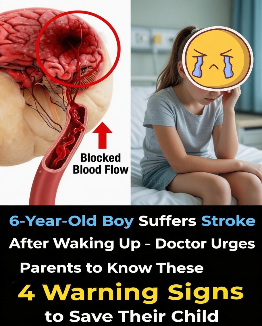 6-Year-Old Boy Suffers a Stroke After Waking Up – Doctor Urges Parents to Recognize These 4 Key Warning Signs to Help Protect Their Child