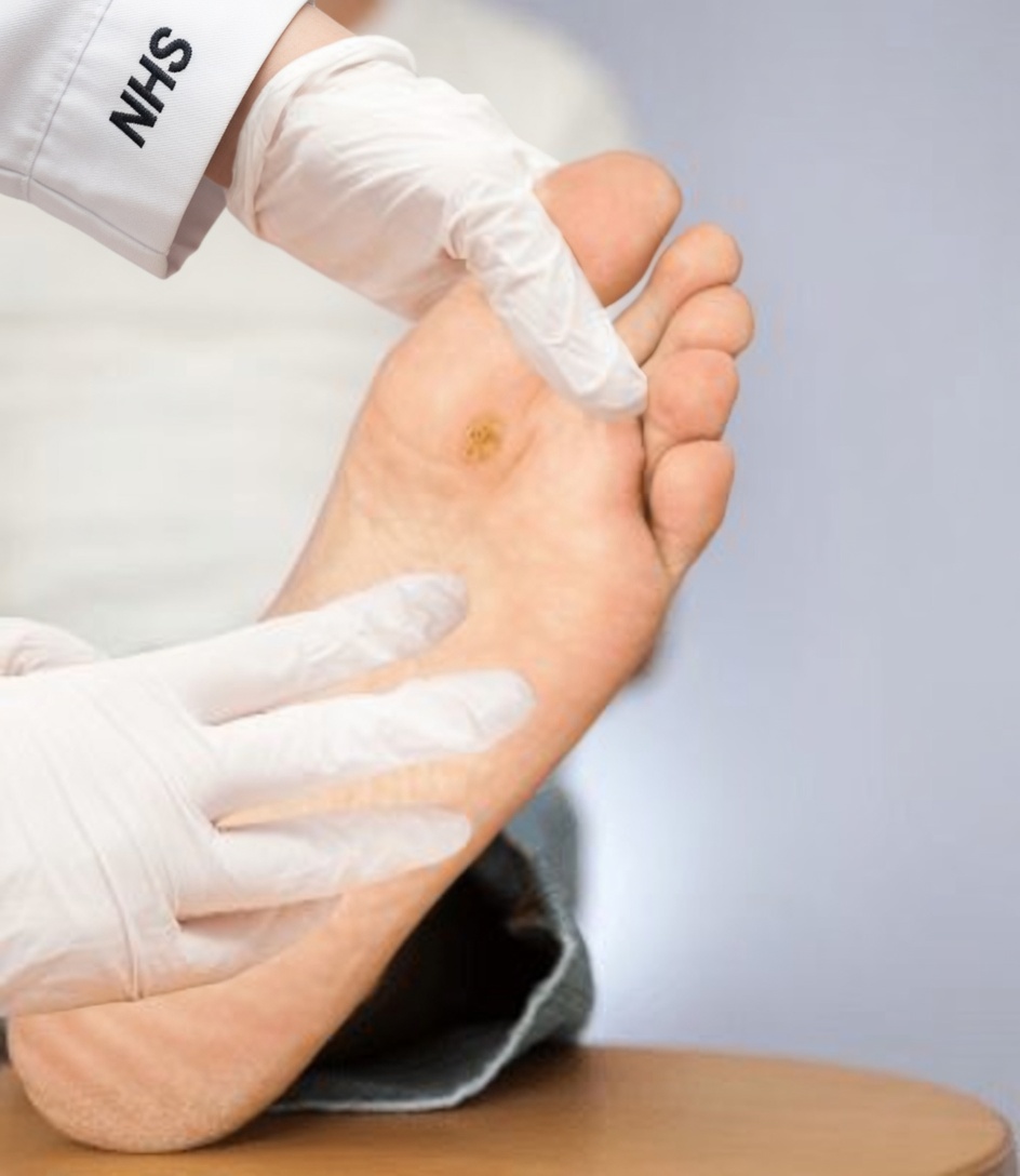 Can Hydrogen Peroxide Help with Warts? Practical Uses, Safety Tips, and What to Expect at Home