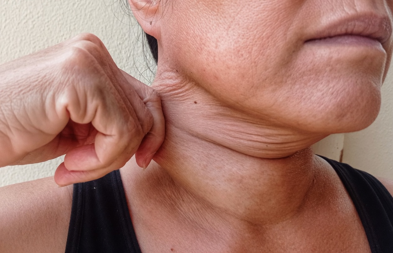 Why Does Your Neck Skin Start to Sag? Understanding the Causes and Simple Habits to Help Maintain Firmer-Looking Skin