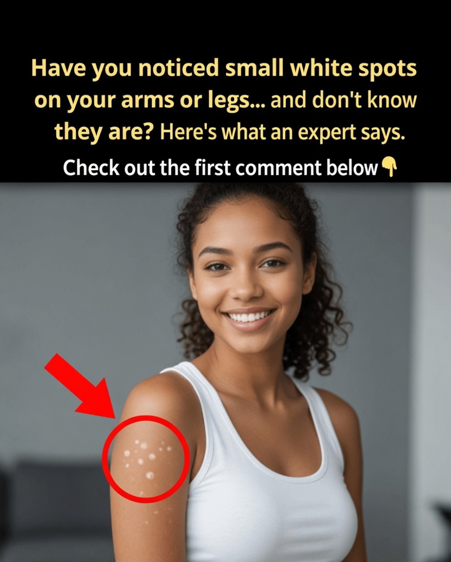 Why Do White Spots Appear on Your Skin? Common Causes and What to Know