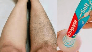 Exploring a Popular Natural Hair Removal Hack: Onion and Toothpaste