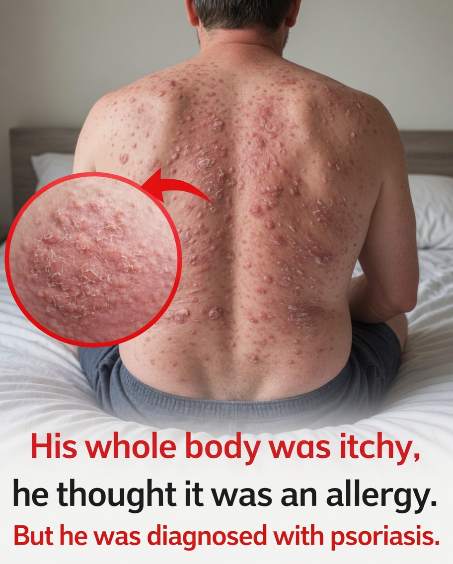 Persistent Itching Beyond Allergies: When It Might Signal Something More Serious