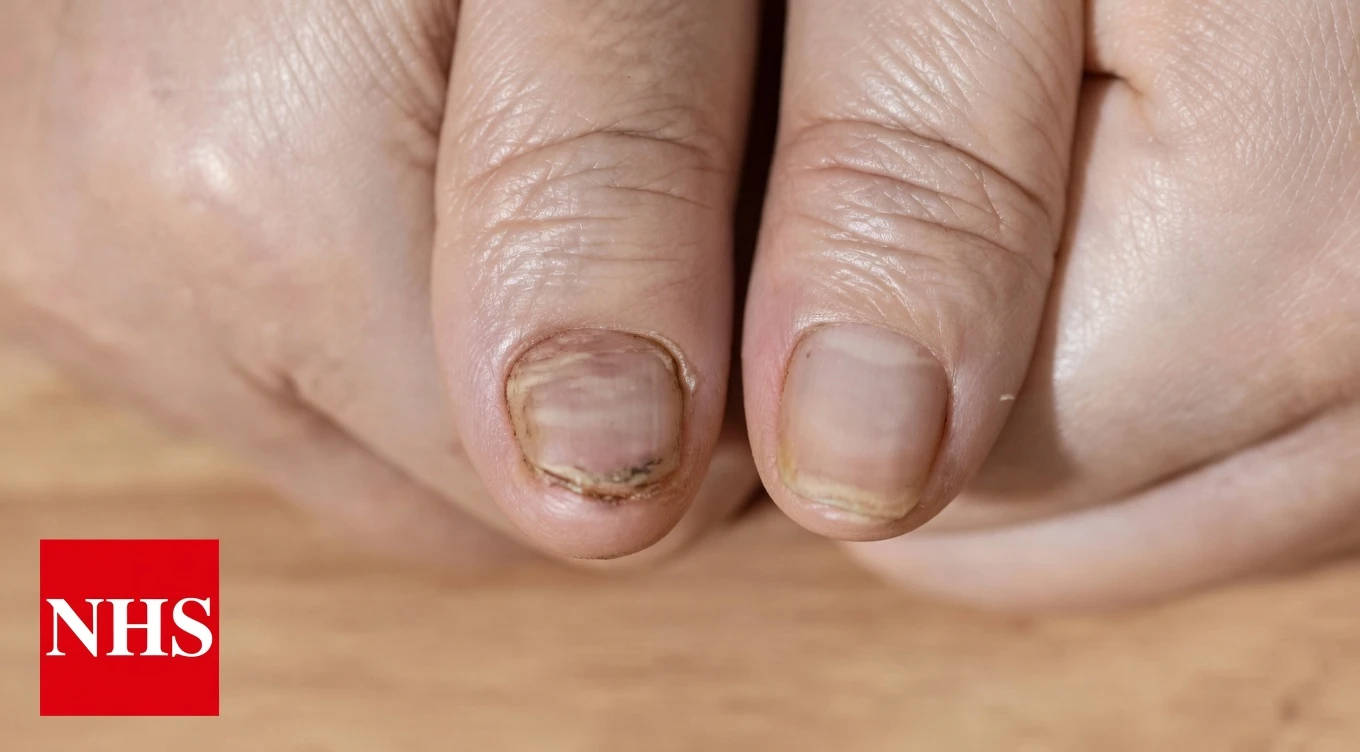 Brittle Nails? 10 Hidden Causes Your Body May Be Signaling – And Simple Ways to Support Stronger Nails