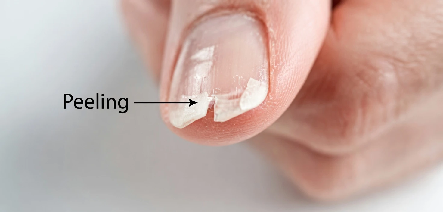 Brittle Nails? 10 Hidden Causes Your Body May Be Signaling – And Simple Ways to Support Stronger Nails