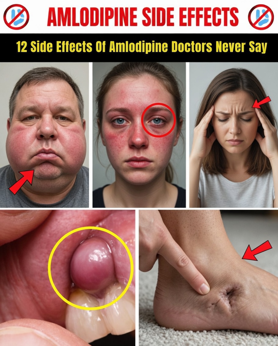 12 Lesser-Known Amlodipine Side Effects You Should Be Aware Of