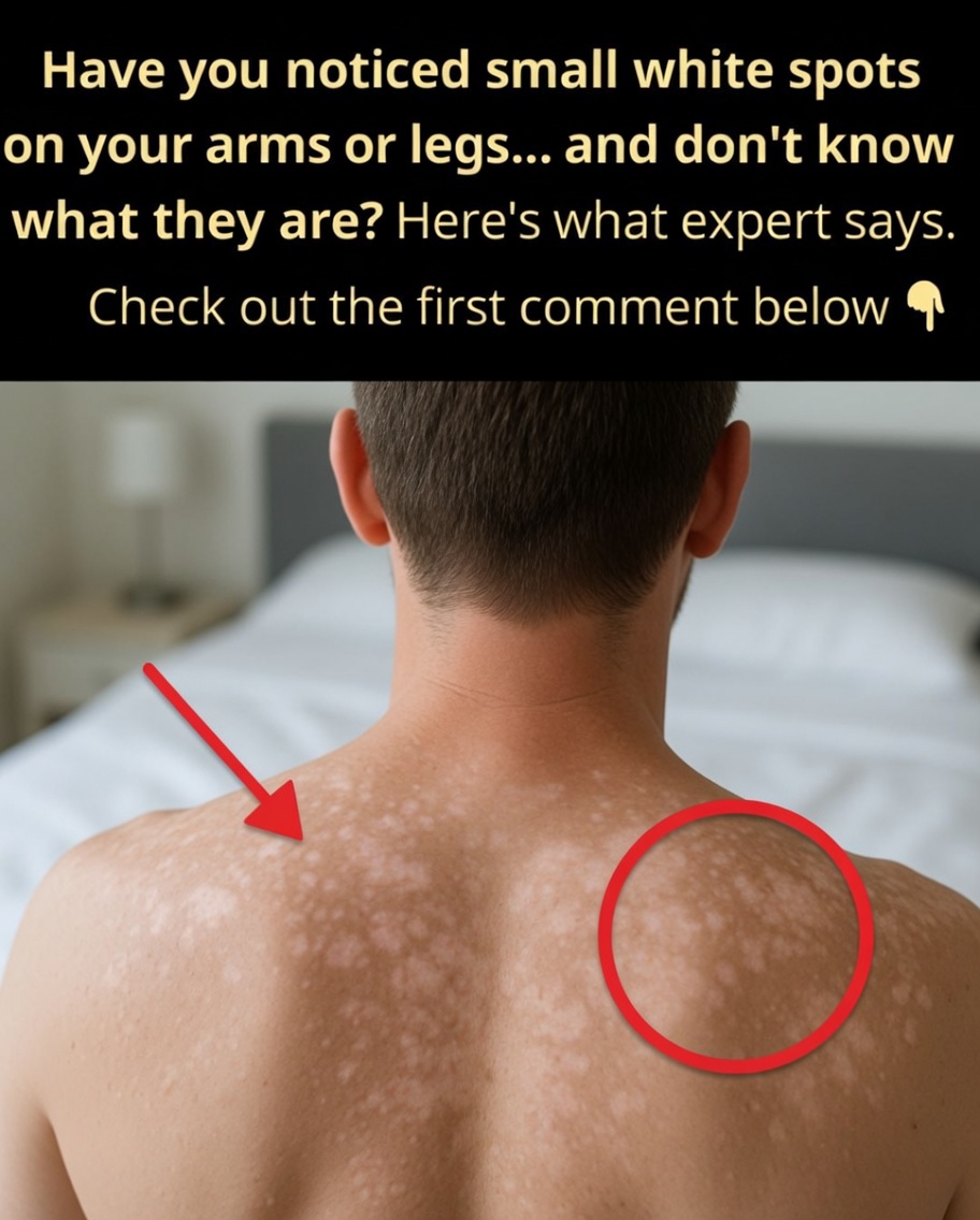 Why Do White Spots Appear on Your Skin? Common Causes and What to Know